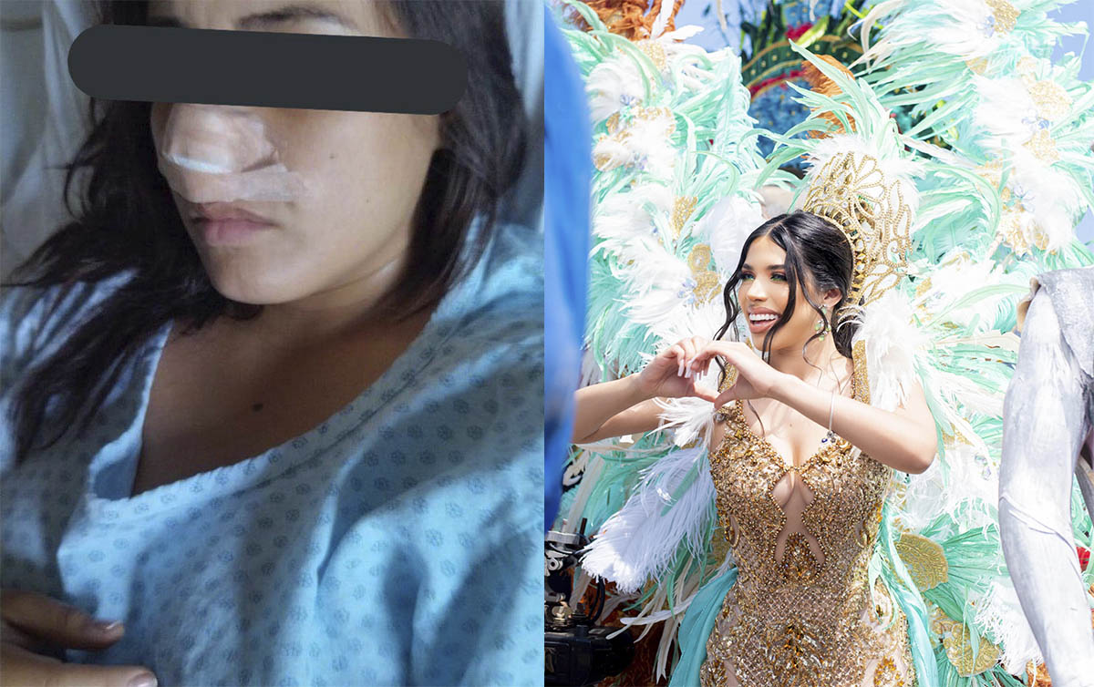 Yeri Mua pagará segunda cirugía de nariz a joven agredida en Veracruz